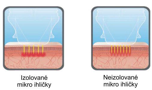 izolované neizolované ihličky